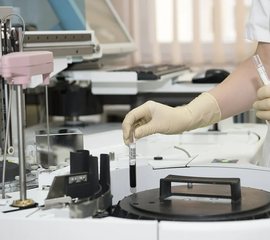 A lab specialist preparing a sample for testing